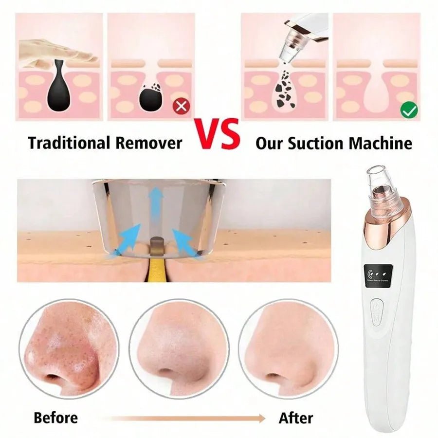 Y03 Blackhead Remover Pore Vacuum,FacialPoreCleaner Kit for Adult ExtractorTool Blackhead Remover Pore Vacuum - H. home supplies
